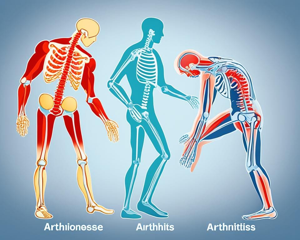 Symptome von Arthrose und Arthritis